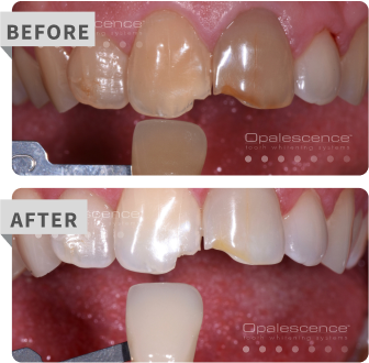 pf before after