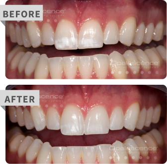 specialty before after
