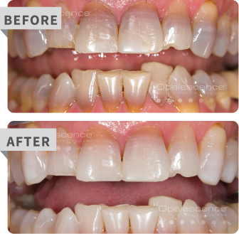 boost before after