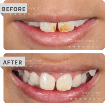 specialty before after