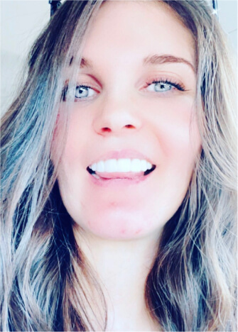 Opalescence Teeth Whitening Customer