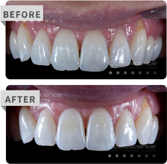 specialty before after
