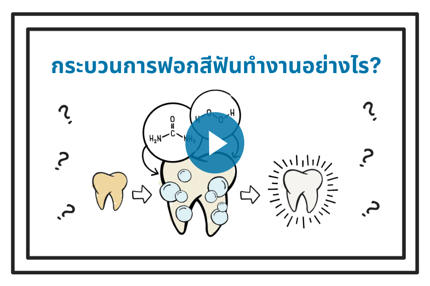How Teeth Whitening Works Video