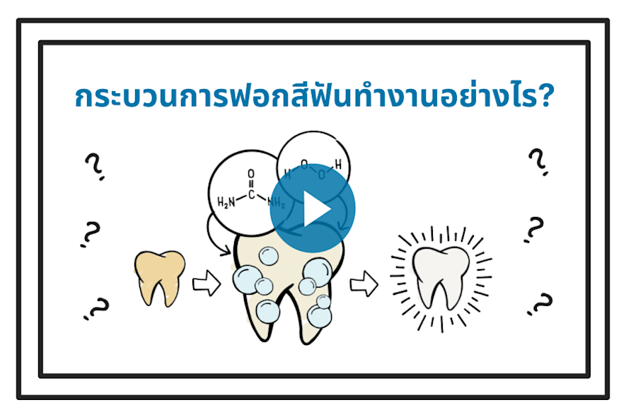How it works video