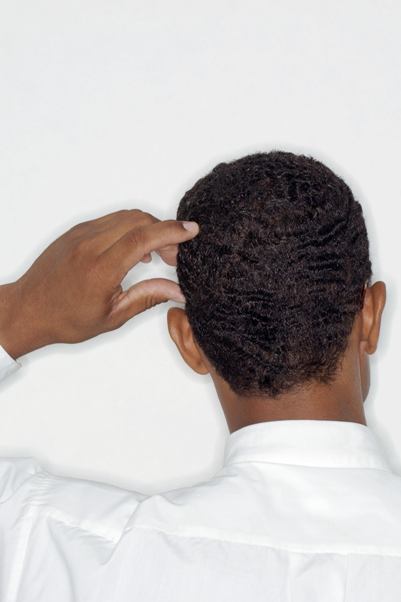 Does Dandruff Cause Itchy Bumps On The Scalp Head Shoulders