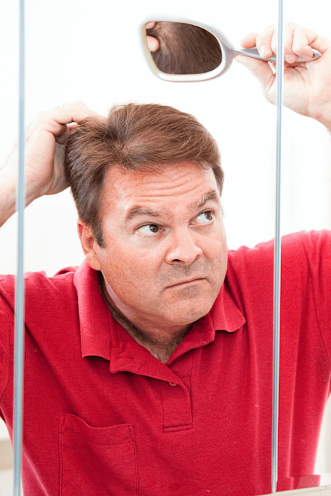 HOW BEST TO REGROW HAIR AT THE CROWN-image HOW BEST TO REGROW HAIR AT THE CROWN-image