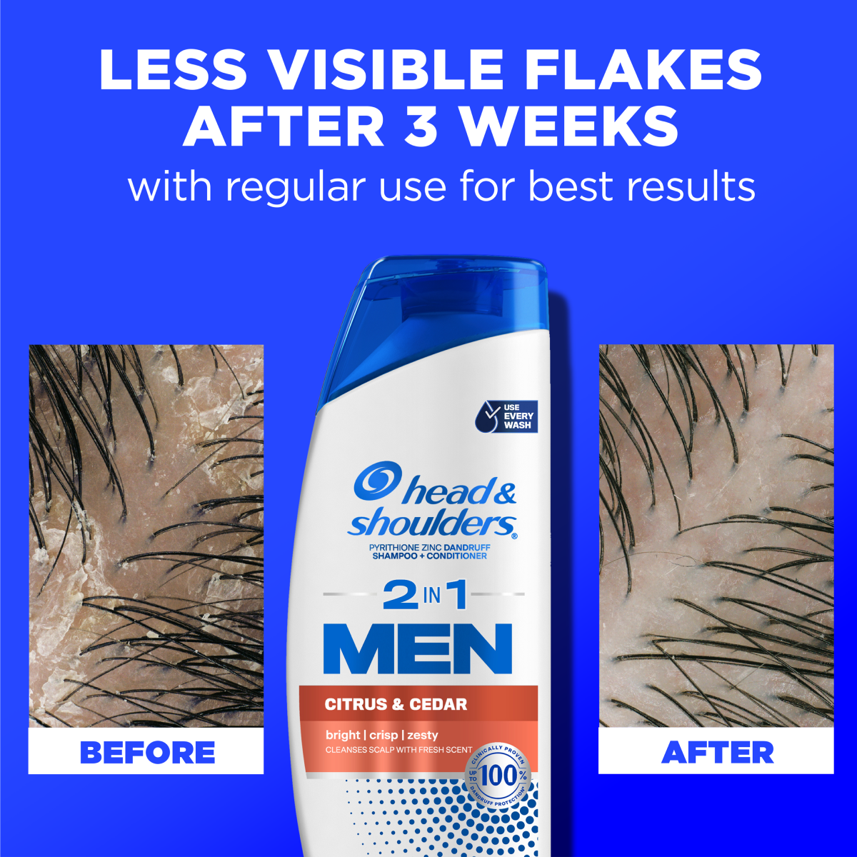 Mens 2 in 1 Dandruff Shampoo and Conditioner, Citrus & Cedar