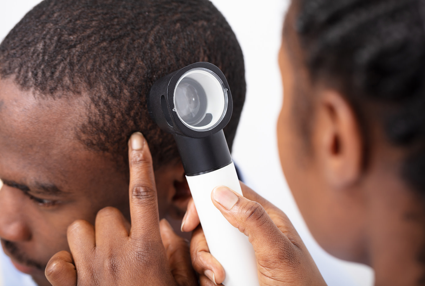 FAQ: IS THERE A LINK BETWEEN ACNE AND DANDRUFF? FAQ: IS THERE A LINK BETWEEN ACNE AND DANDRUFF?