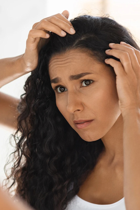 Dry Scalp and Dandruff-image Dry Scalp and Dandruff-image