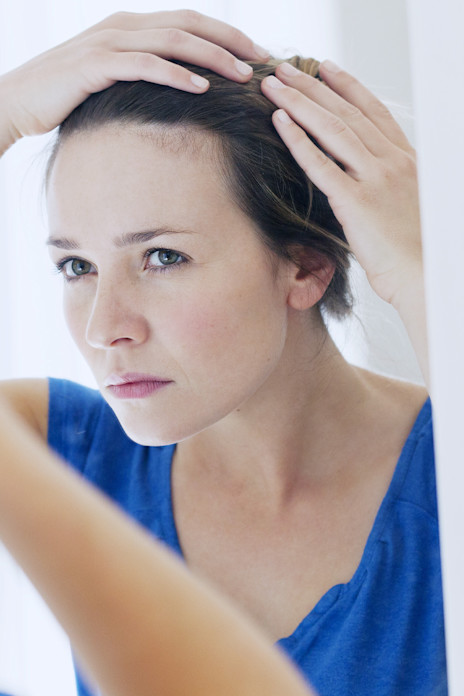 THE 5 BIGGEST CAUSES FOR HAIR LOSS IN WOMEN-image THE 5 BIGGEST CAUSES FOR HAIR LOSS IN WOMEN-image