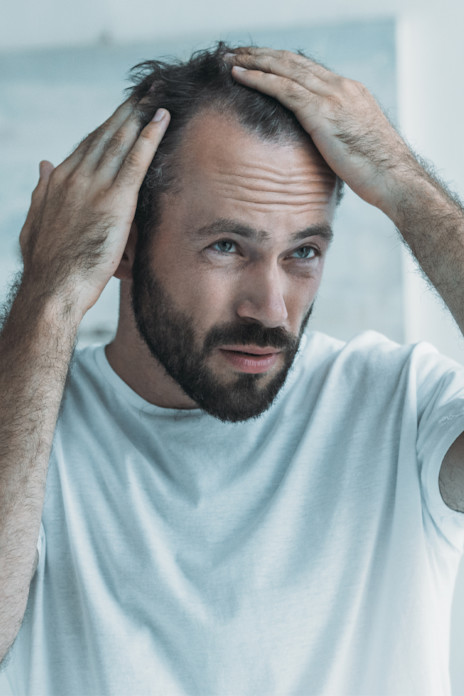HOW DOES MINOXIDIL WORK FOR HAIR LOSS?-image HOW DOES MINOXIDIL WORK FOR HAIR LOSS?-image