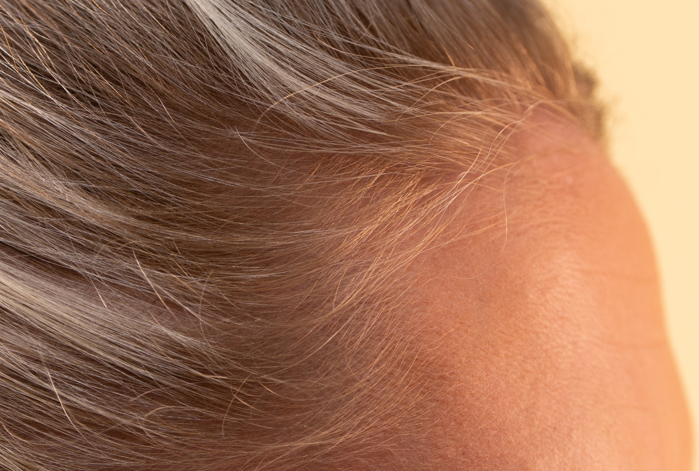 Close-up view of a fair-skinned woman’s blonde hair and scalp, illustrating a common area for dandruff and hair thinning concerns. Close-up view of a fair-skinned woman’s blonde hair and scalp, illustrating a common area for dandruff and hair thinning concerns.