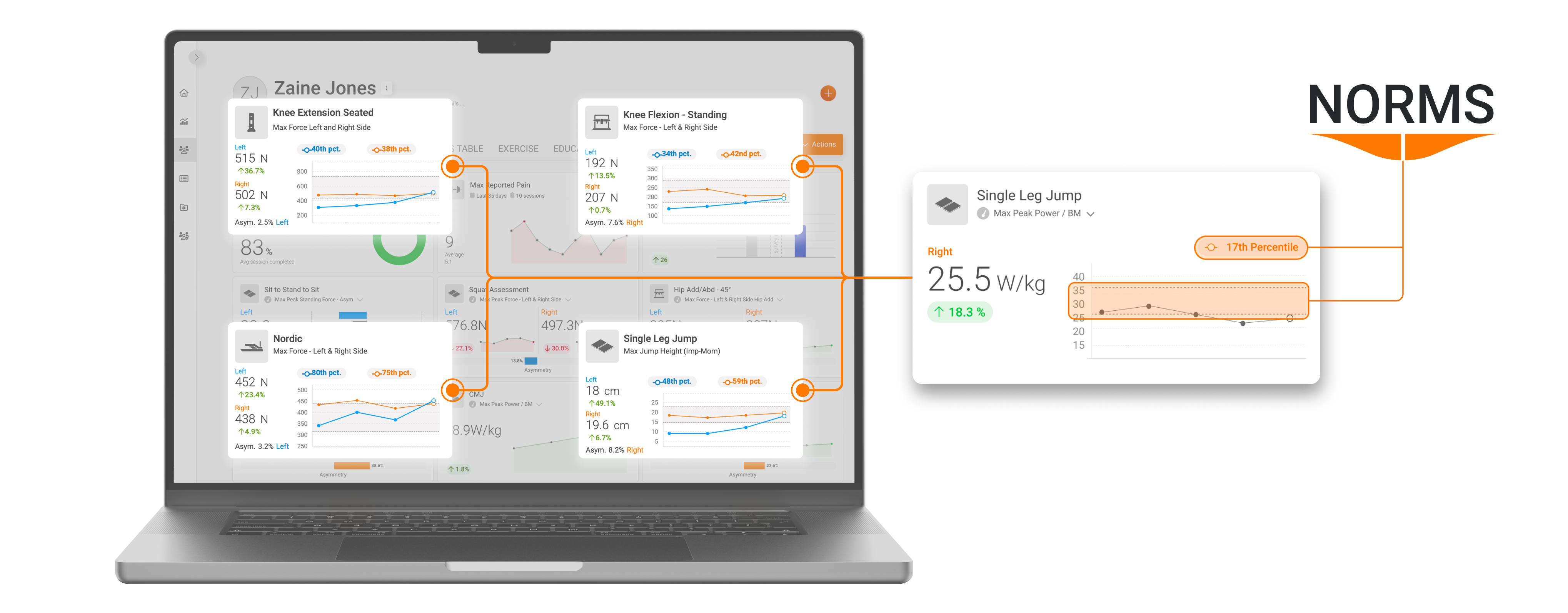 ForceDecks, DynaMo, NordBord and ForceFrame Norms (normative data) integrated into VALD Hub.