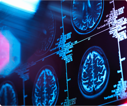Brain scan imaging