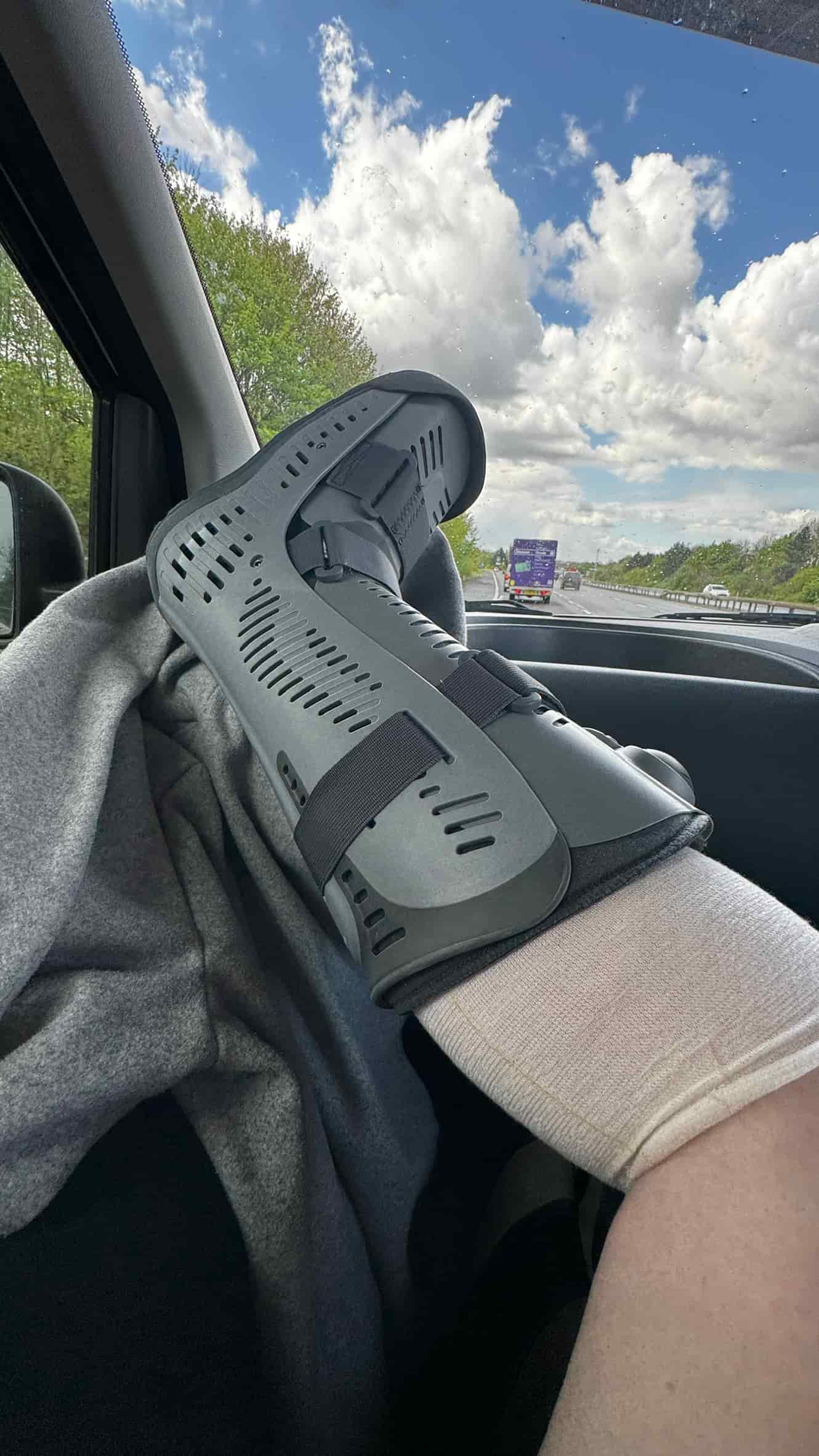 the journey up to Manchester in a very small front seat with a leg that needed elevating!