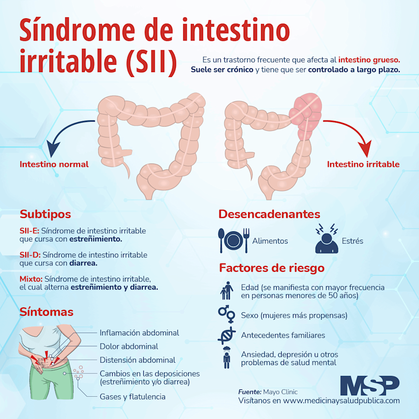 infografia-sobre-el-sindrome-del-intestino-irritable-y-sus-sintomas-comunes