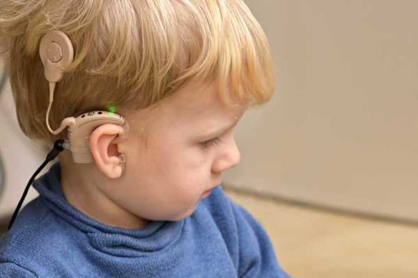 Health: Young child with cochlear implant.