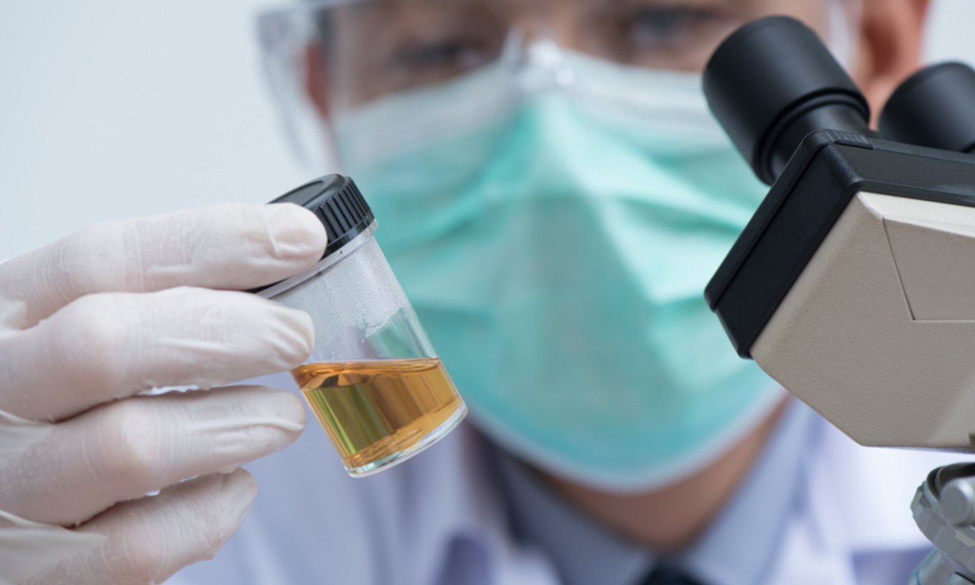 THCA Drug Test Detection Windows and the Four Factors That Control Your Results
