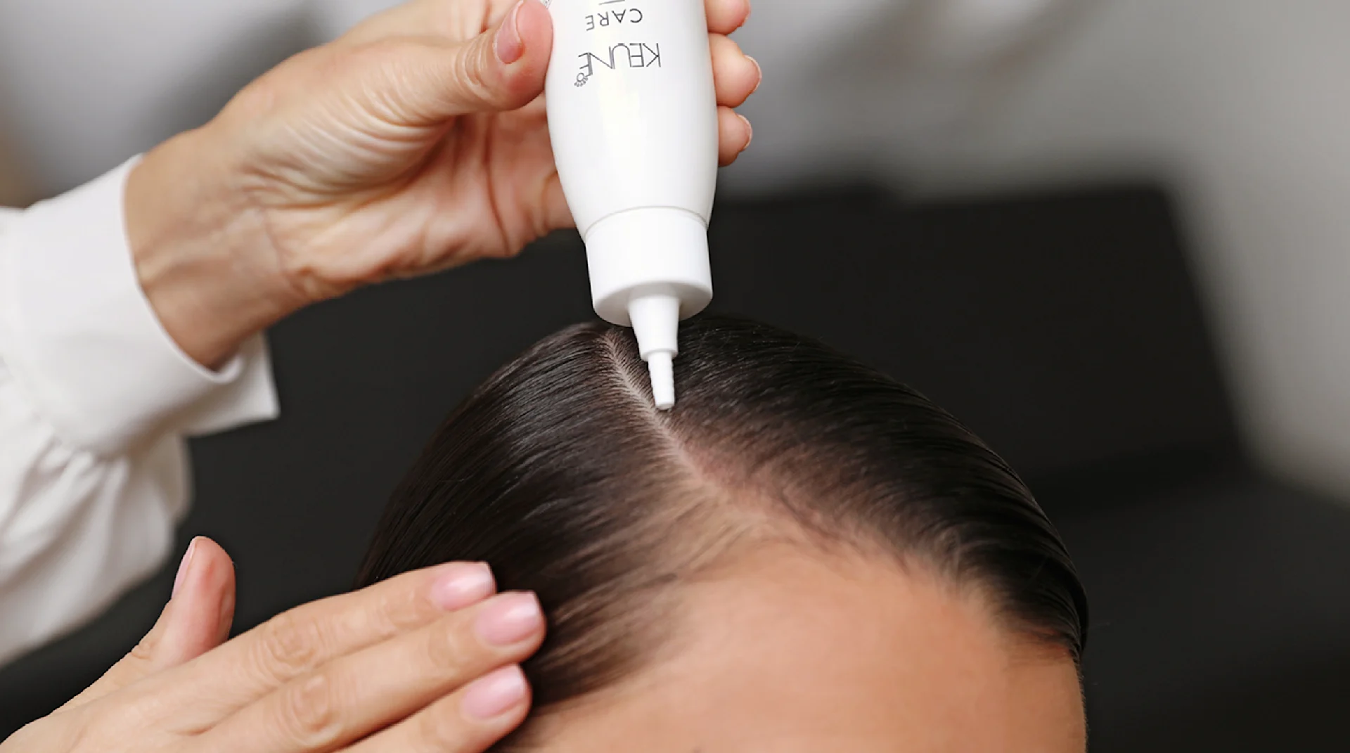 Scalp Problems Diagnose Your Condition With These Clear Images - lz7cz14