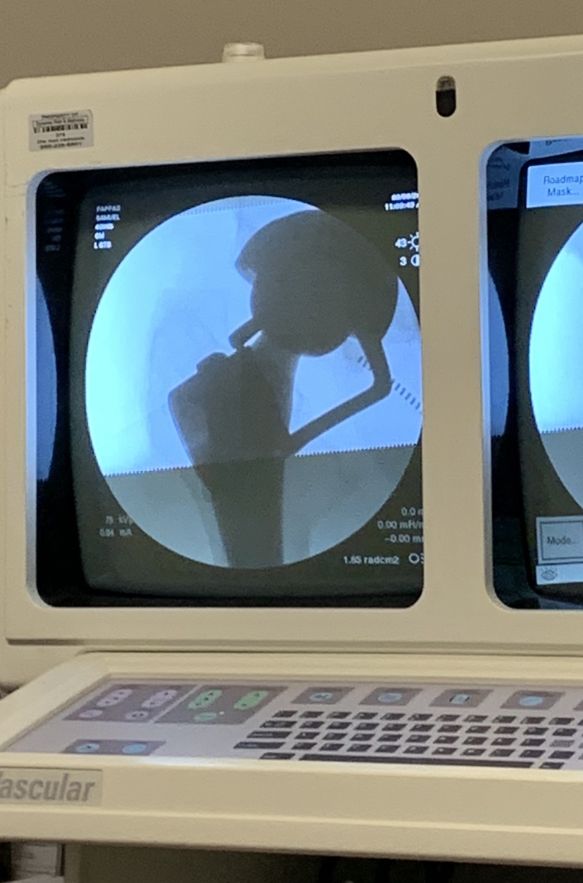 Samuel Pappas - Hip Surgery