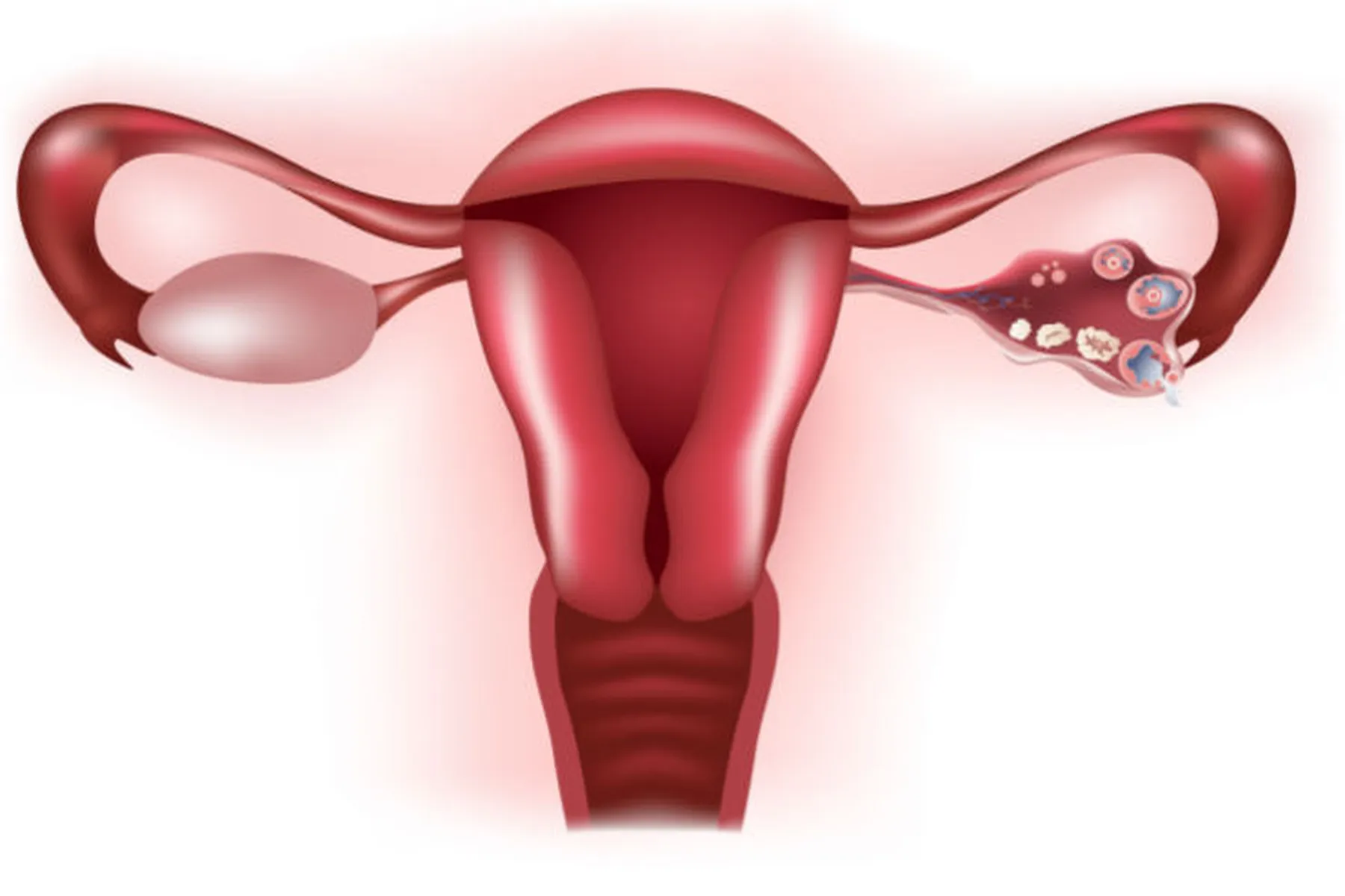 A diagram drawing of the female reproductive system. 