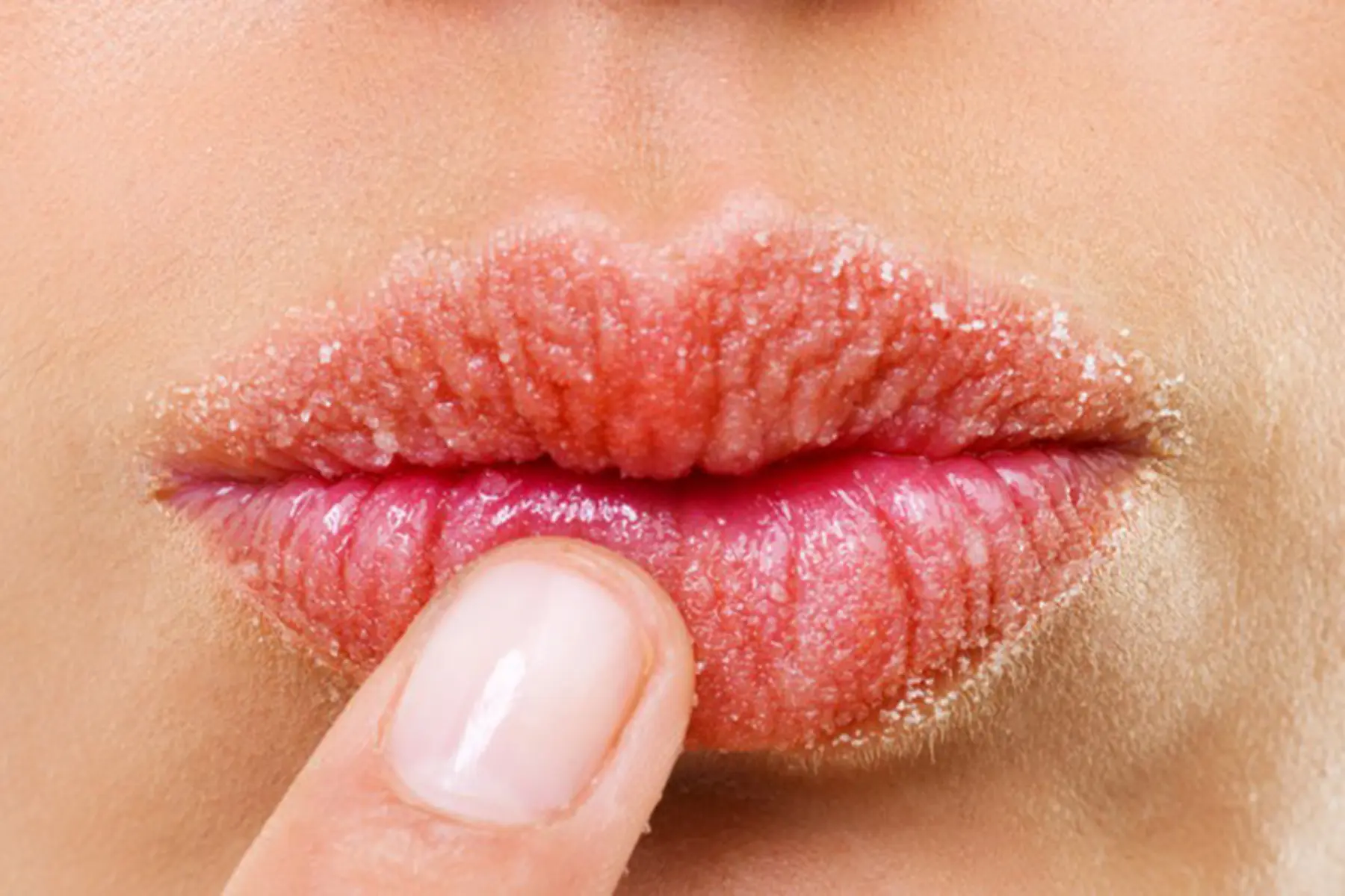 Woman touching her chapped and inflamed lips.