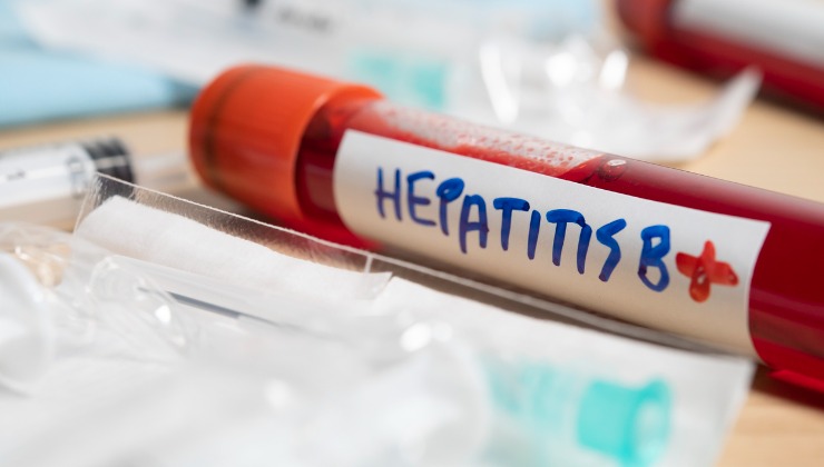 Positive hepatitis B test.