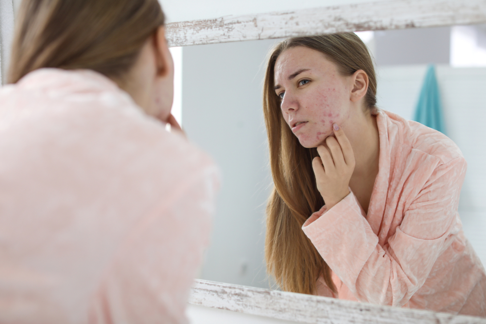 Girl looking in the mirror at the acne on her cheek.