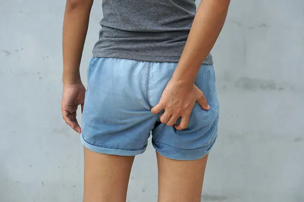 A woman stands in shorts and itches at her buttocks.