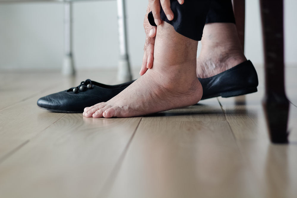 An elderly woman putting her swollen feet into black shoes