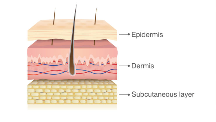 Is My Rash Ringworm or Something Else? | LifeMD