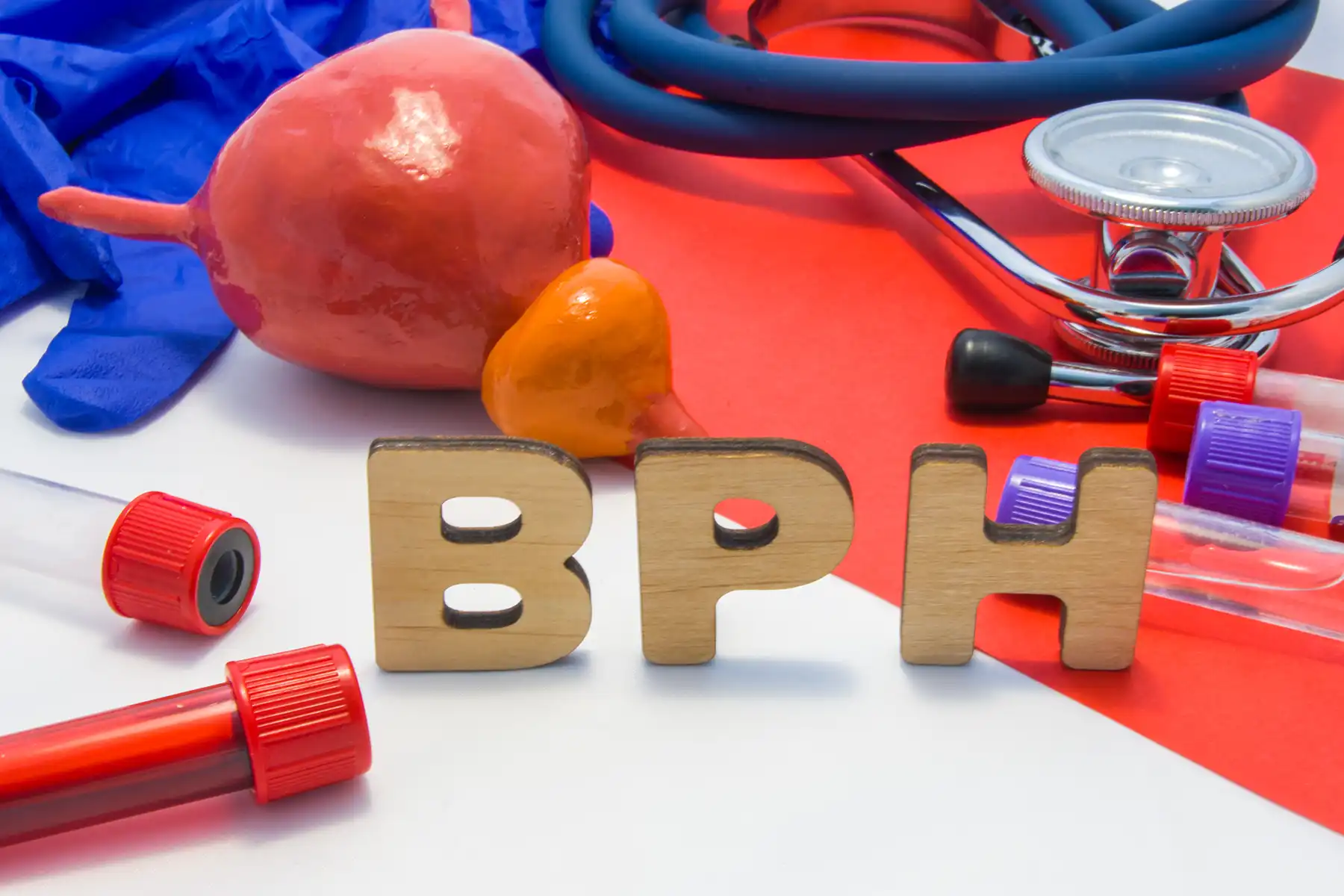 Wooden blocks that say BPH with a model of a prostate and test tubed surrounding it.