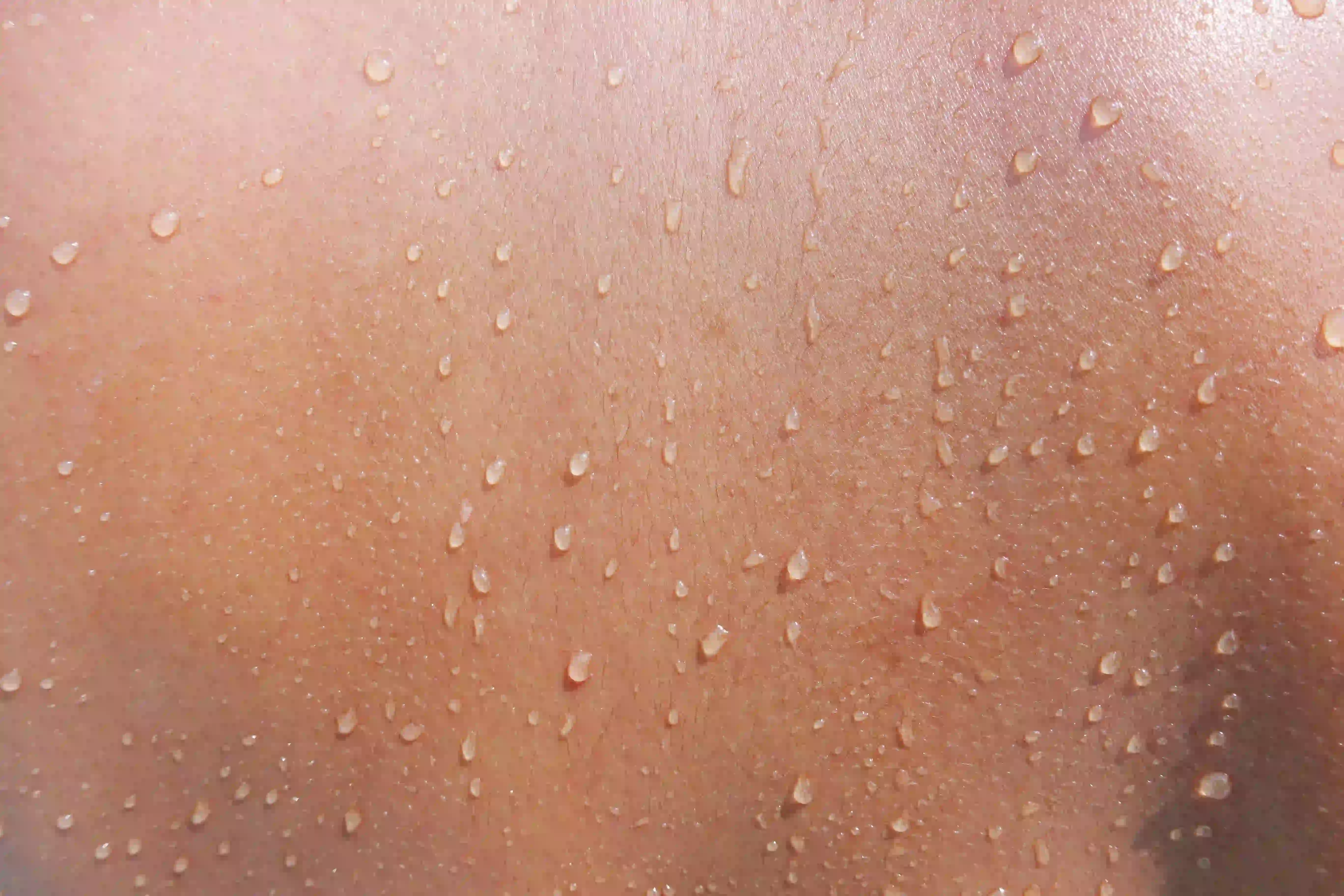 Sweaty skin