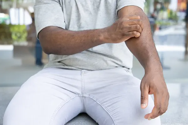 A man sitting down itches his inner arm with his other hand.