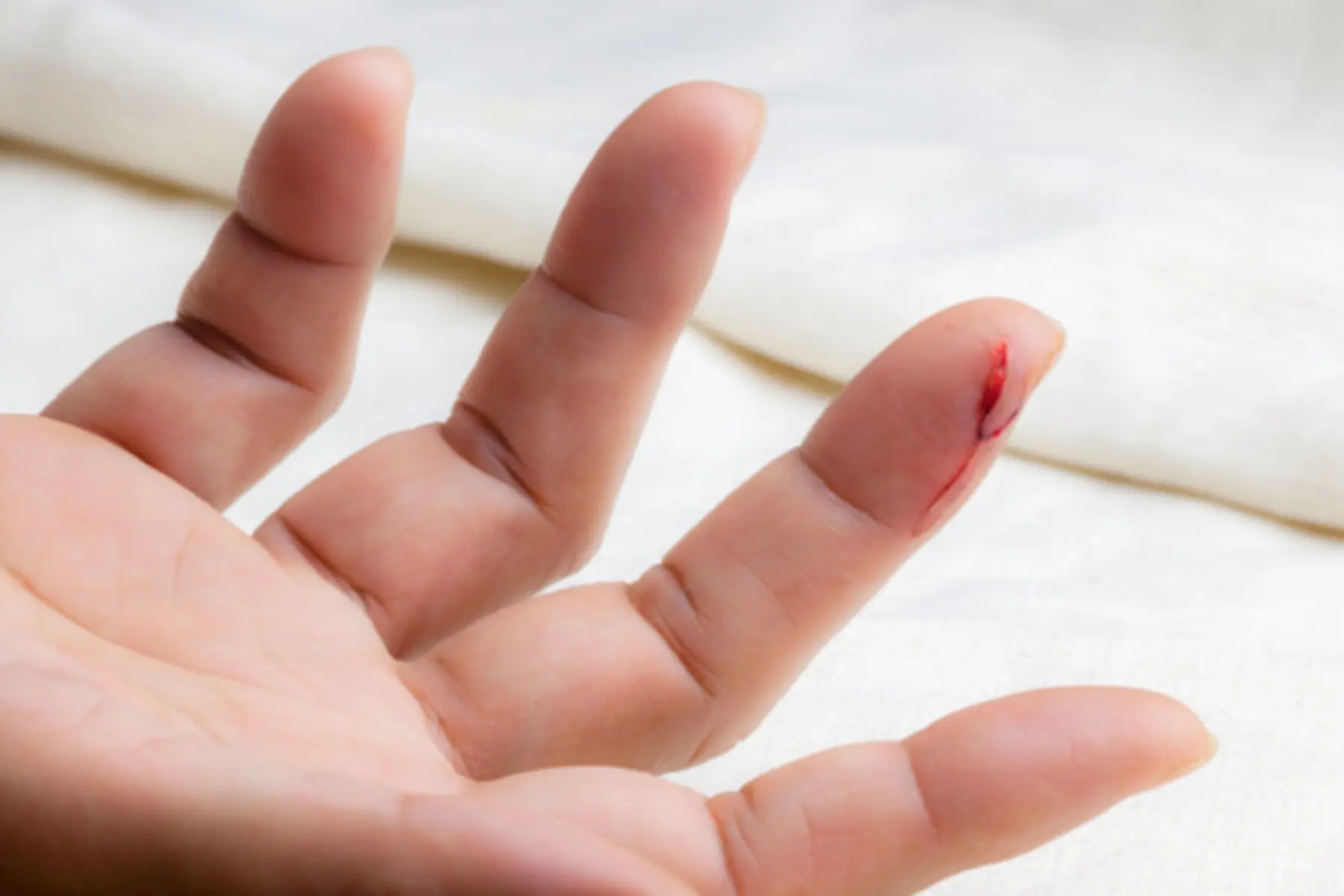 Best Antibiotics for Wound Infections LifeMD