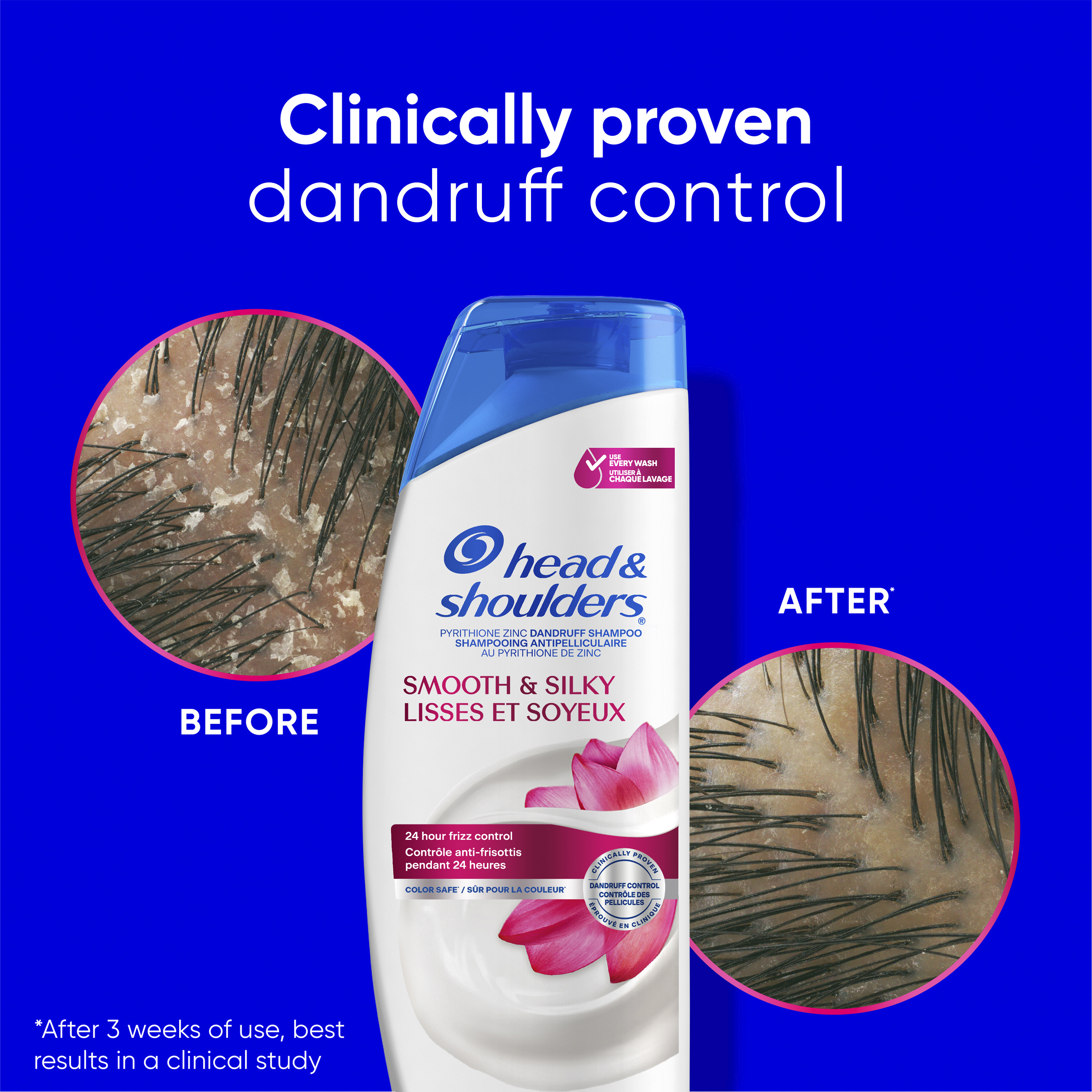Smooth & Silky Dandruff Shampoo, Frizz Control