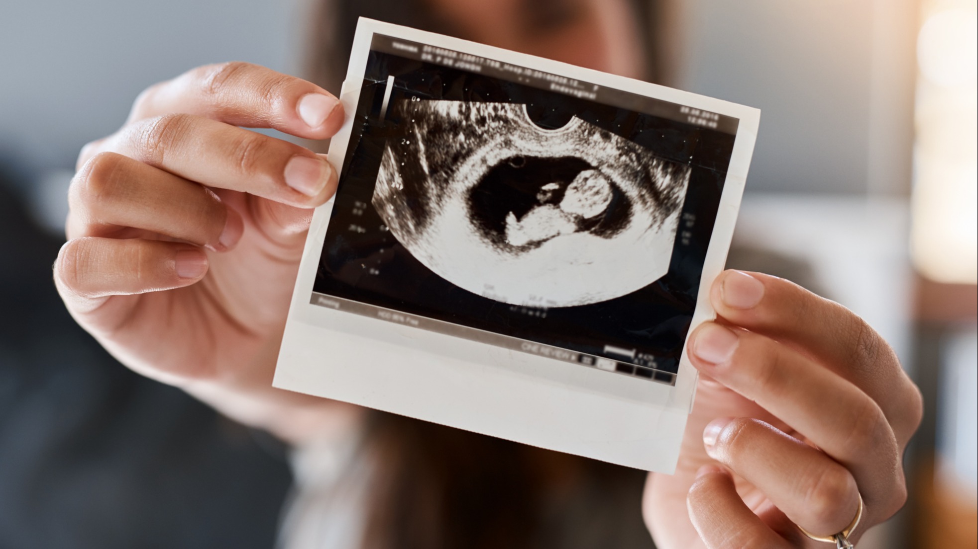 What to Do if Your Friend Doesn't Want a Baby Shower