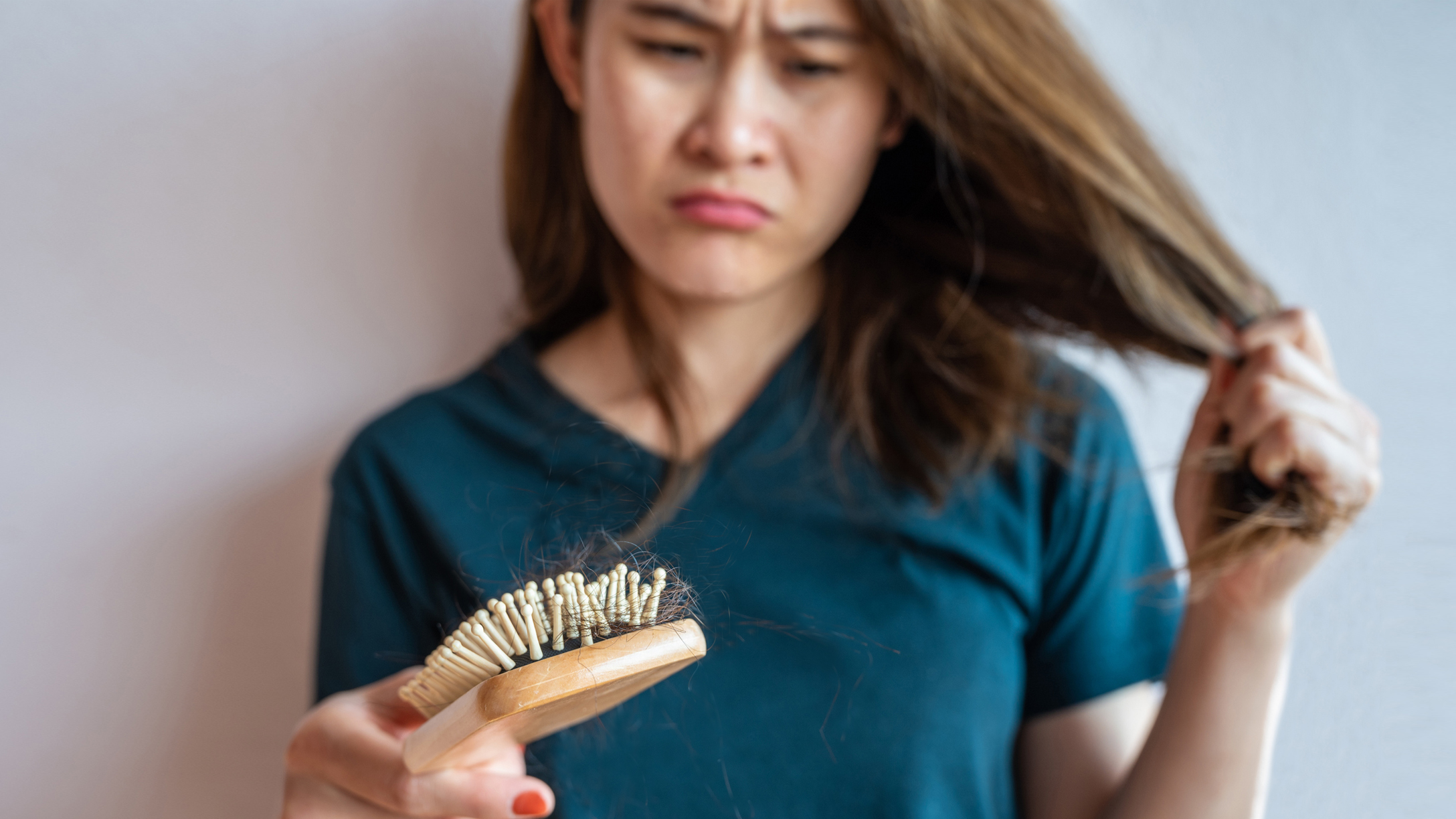 On Postpartum Hair Loss