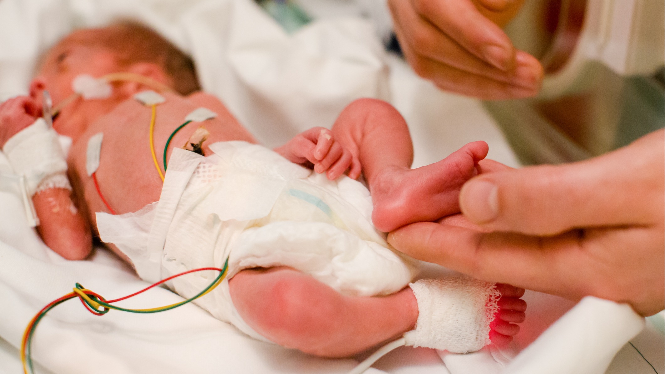 9 Things No One Tells You About Giving Birth to a Micro-Preemie image