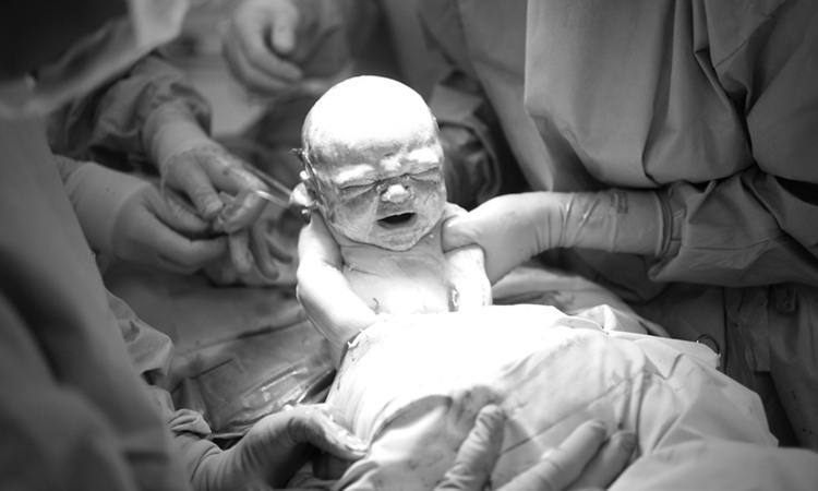 What It Feels Like to Have an Unmedicated C-Section - Mom.com