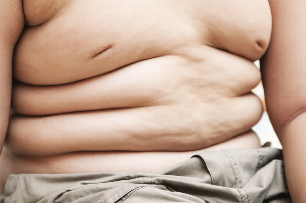 As Boys Get Fatter, Parents Worry One Body Part Is Too Small - The