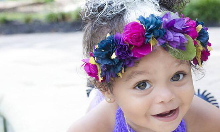 Baby Inherits Rare Birthmark Like Generations Of Women Before