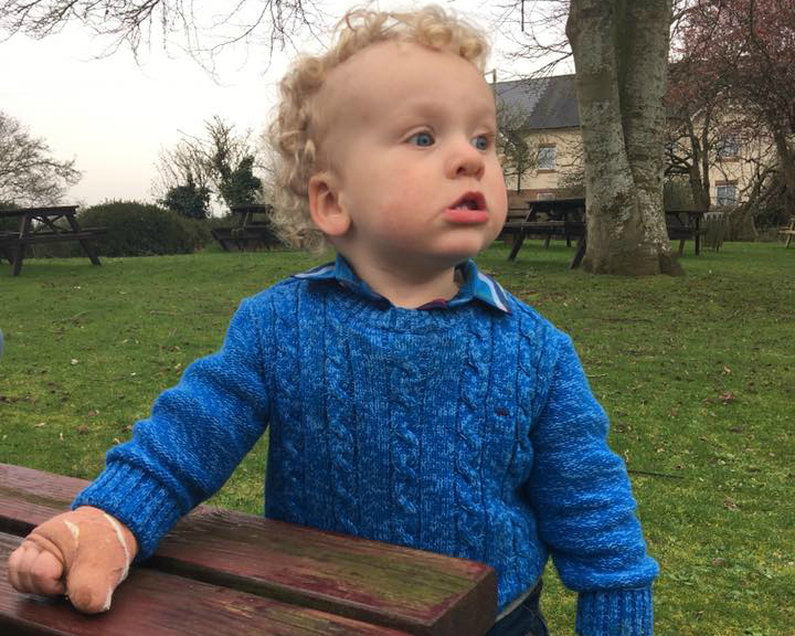 Toddler May Need Surgery After Vacuum Cleaner Injury