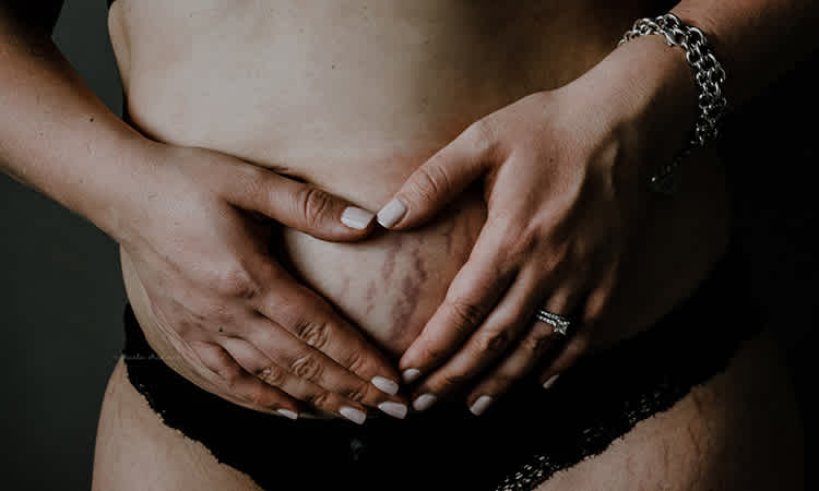 Raw, Real Photos of Women's Postpartum Bodies Celebrate the Beauty of Birth