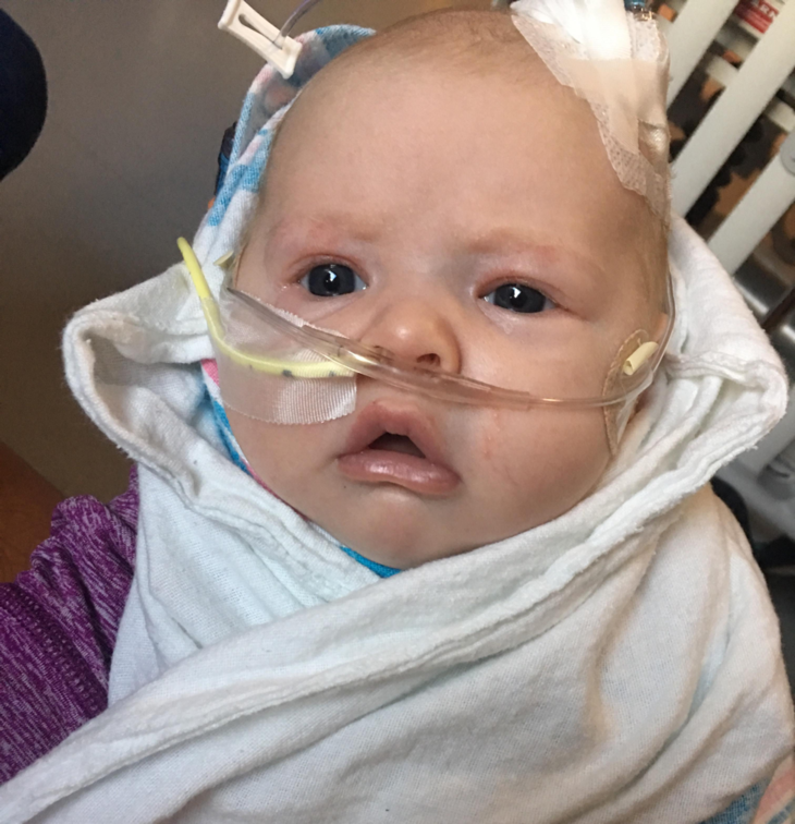 My Healthy Baby Was Kissed During RSV Season And It Almost Killed Her   241352 Rsv Baby 