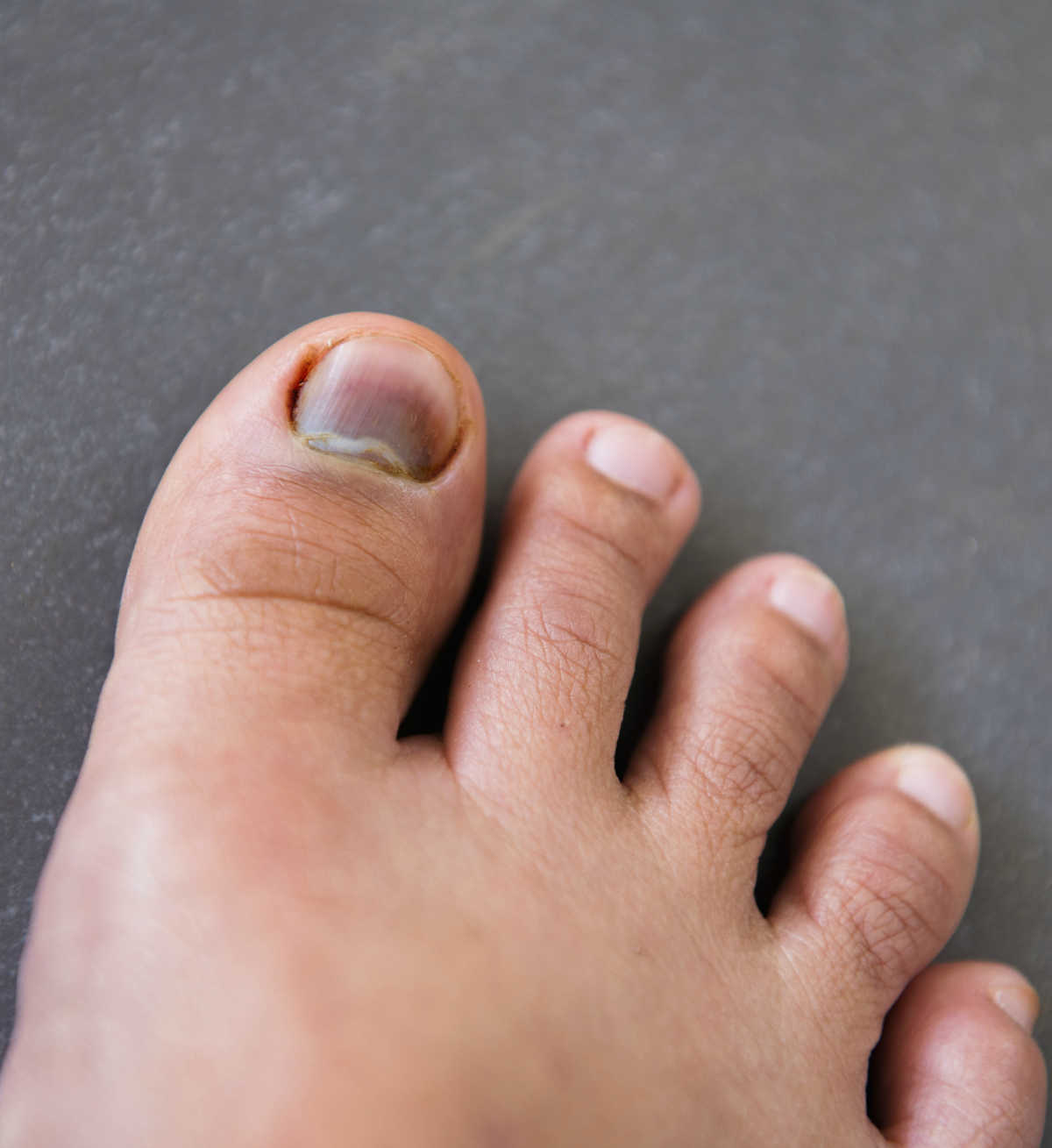 19 Health Problems That Show Up in Your Nails