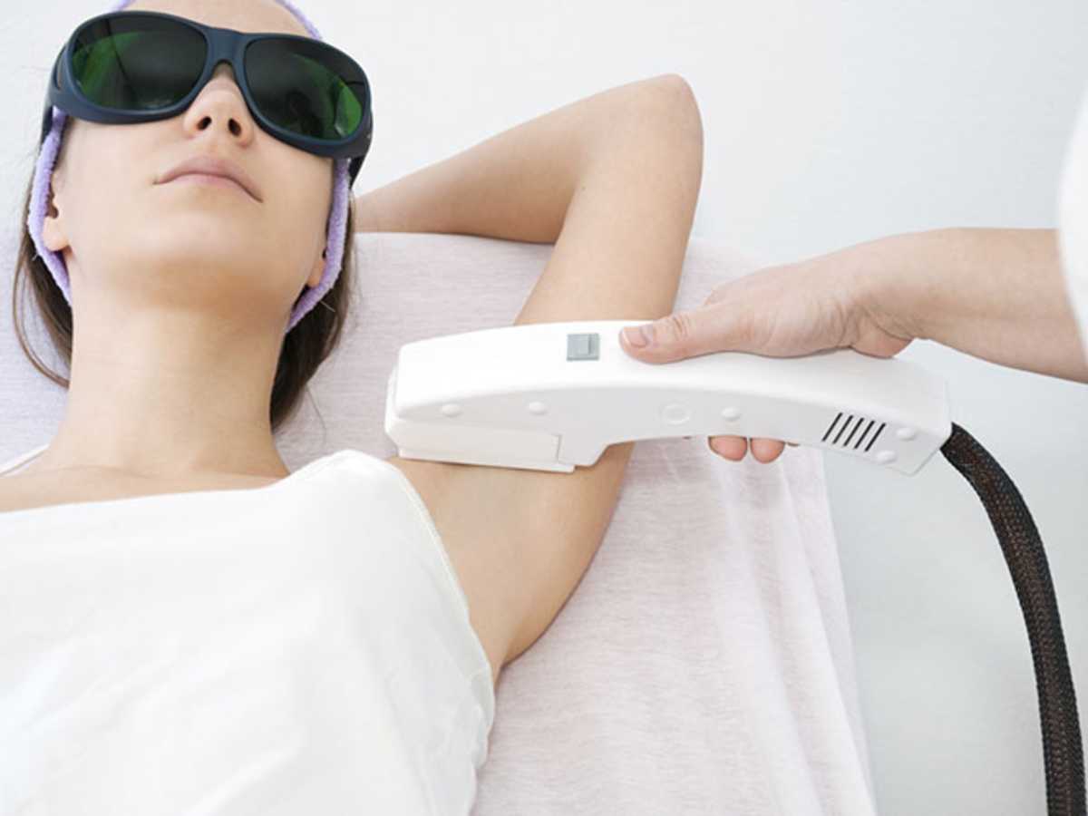 A Hairy Girl's Guide to Laser Hair Removal 