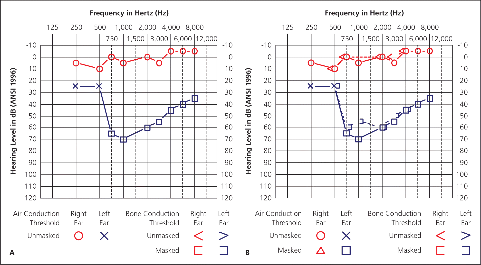 Audiometria Tonale