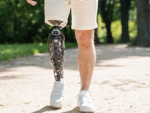 Mann mit einer Beinprothese.