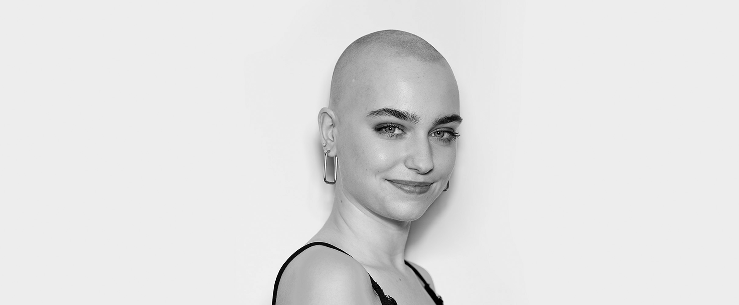Natuurlijk jezelf: Anne 'Ik ben blij dat alopecia in mijn leven kwam'